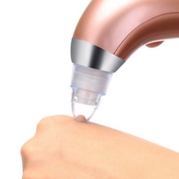 Facial Pore Cleanser Acne & Blackhead Vacuum Remover - Image 2
