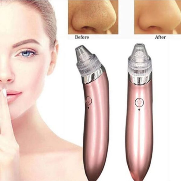 Facial Pore Cleanser Acne & Blackhead Vacuum Remover - Image 3